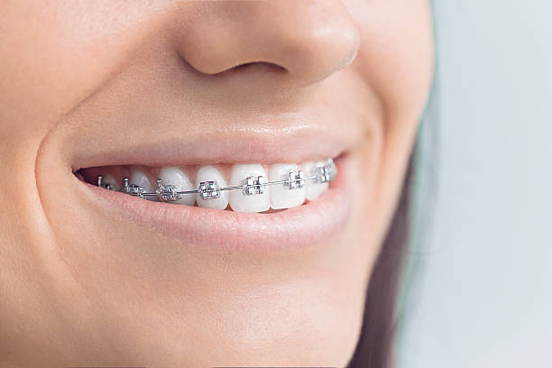Why Choose Us for Your Dental Needs in Stansbury Park, UT